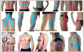 kinesiologisches Taping